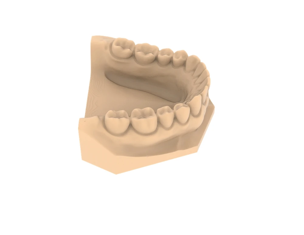 Precision Model Resin Guide 2026: Qhov Zoo Tshaj Plaws Siab -Precision Dental...